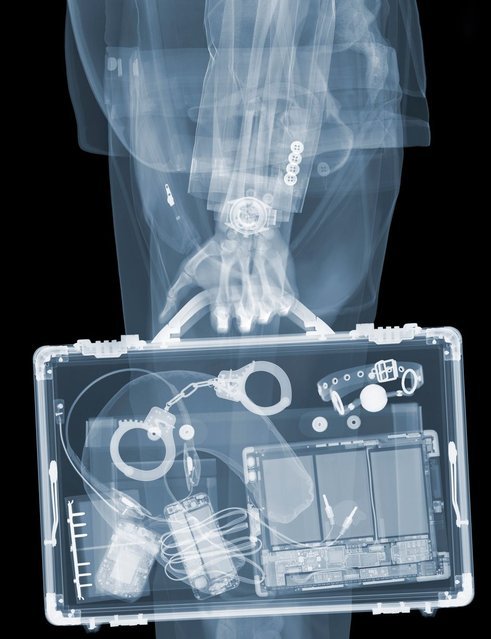 Художественные рентген-работы Ника Визи (8 фото)