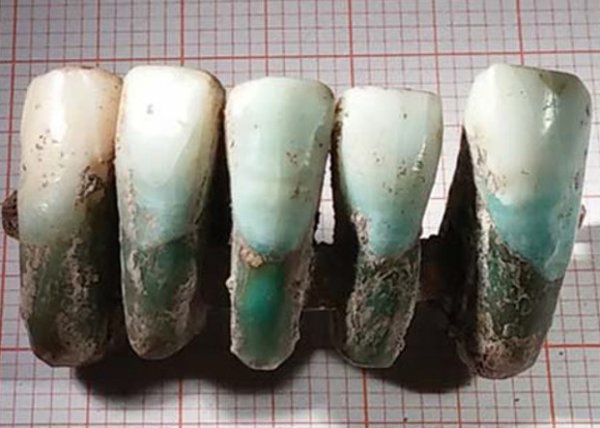 Специалисты в области археологии отыскали зубной протез, возраст которого составляет больше четырёхсот лет